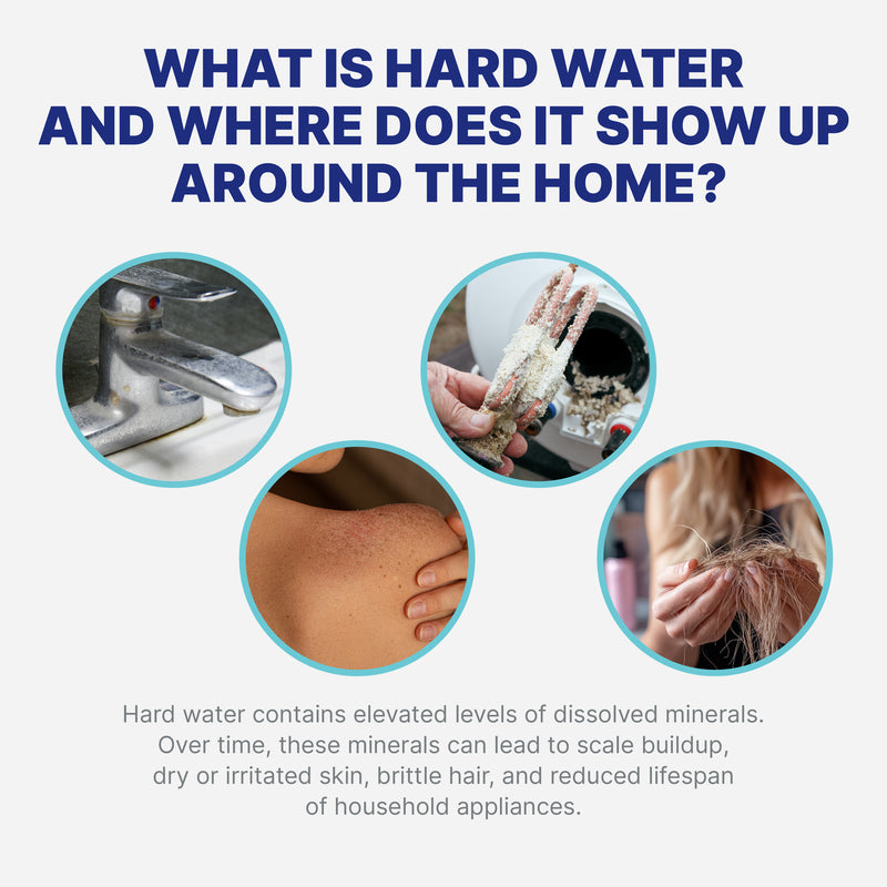 NU Aqua 4 Stage Whole House Salt Free Water Softener With Total Filtration